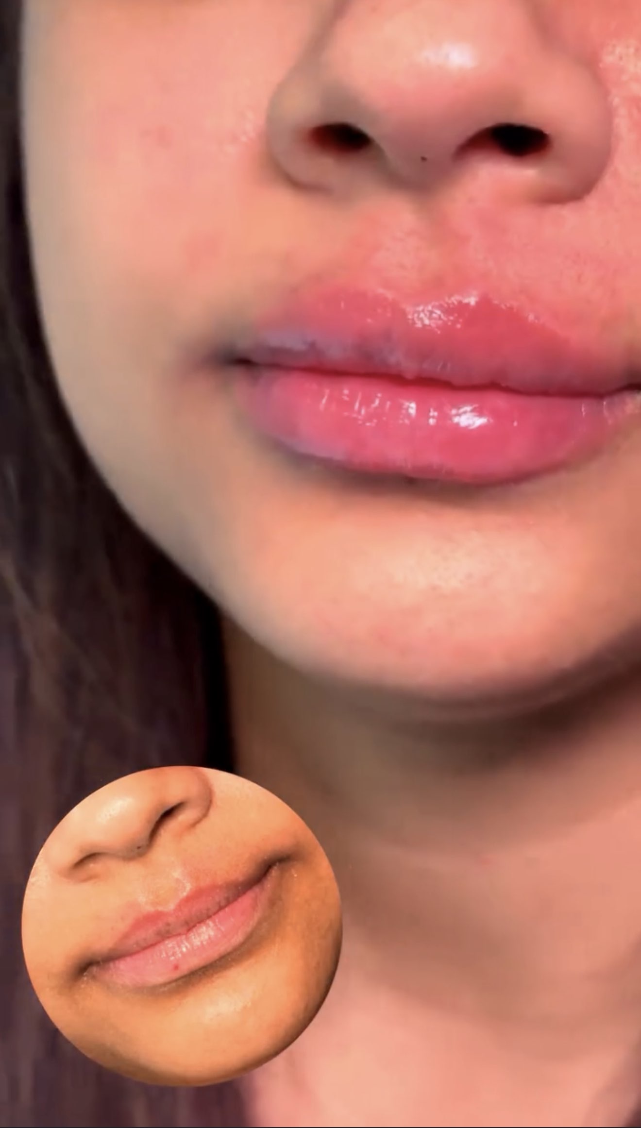 BellaFace beauty detail with lips