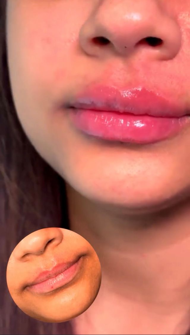 Close-up of full, glossy lips with a smaller inset photo of the lips